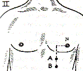 Point A and B